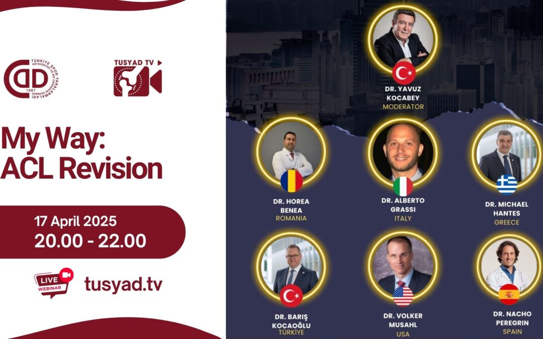 My Way: ACL Revision – 17 April 2025